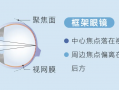 眼镜怎么往线上发展，眼镜怎么往线上发展卖