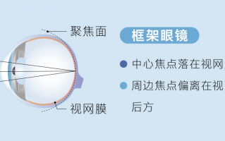 眼镜怎么往线上发展，眼镜怎么往线上发展卖